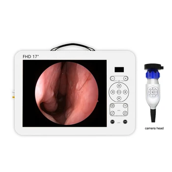 Vroče prodaje Nosni endoskopijo stroškov shrek novega izdelka prenosni full hd kamera endoskop 17